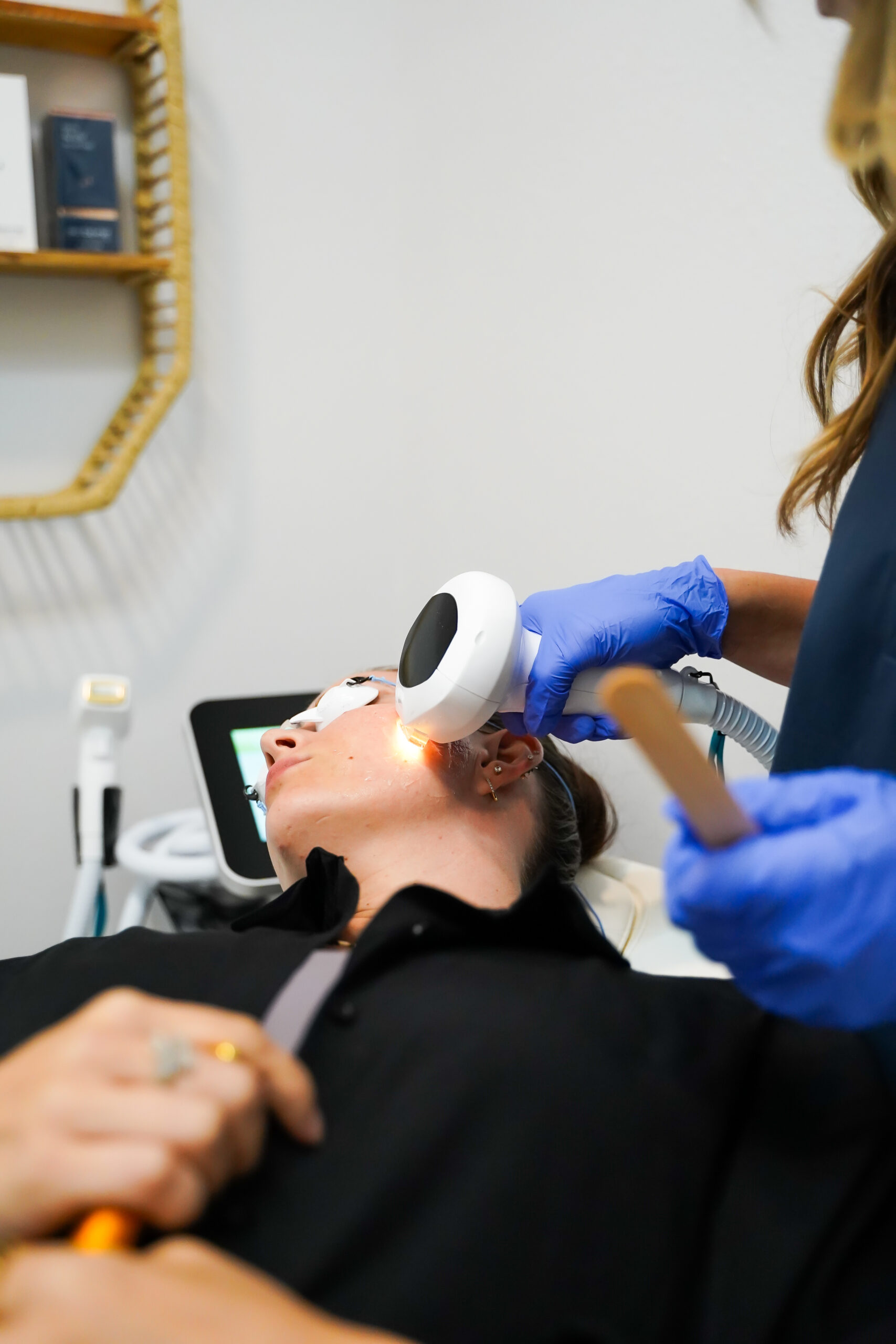 Lumecca IPL before and after results at Roots in Tampa, FL