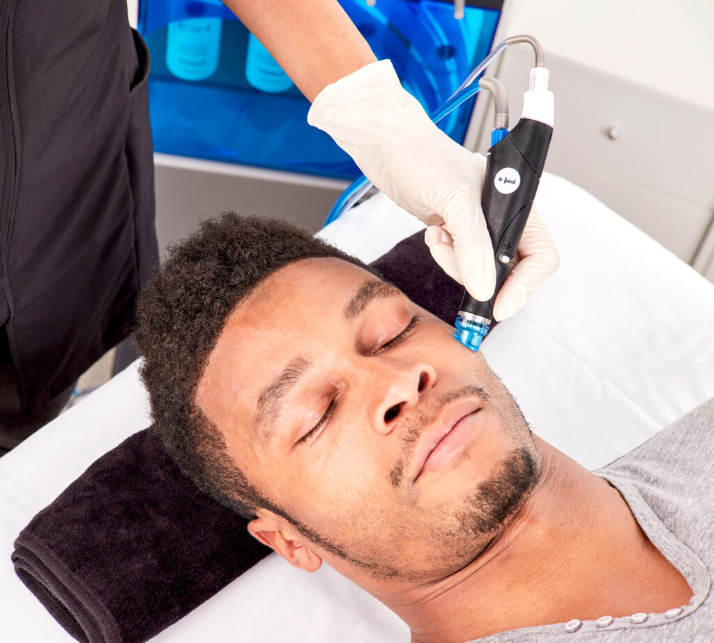 Man getting Hydrafacial treatment for face | Get HydraFacial treatment at Roots Wellness and Medspa in Tampa, Florida