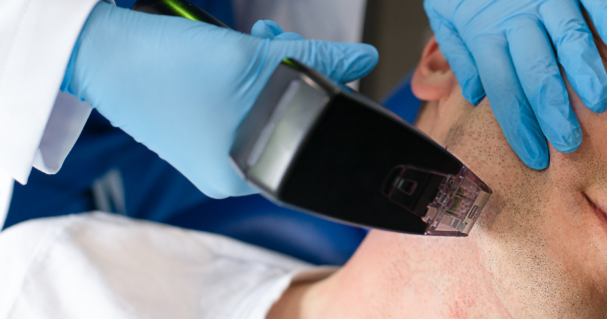 Man receiving Morpheus8 treatment in Tampa, FL