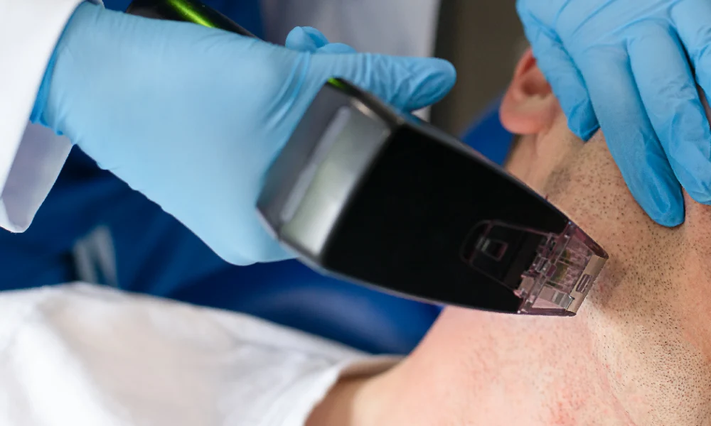 Man receiving Morpheus8 treatment in Tampa, FL