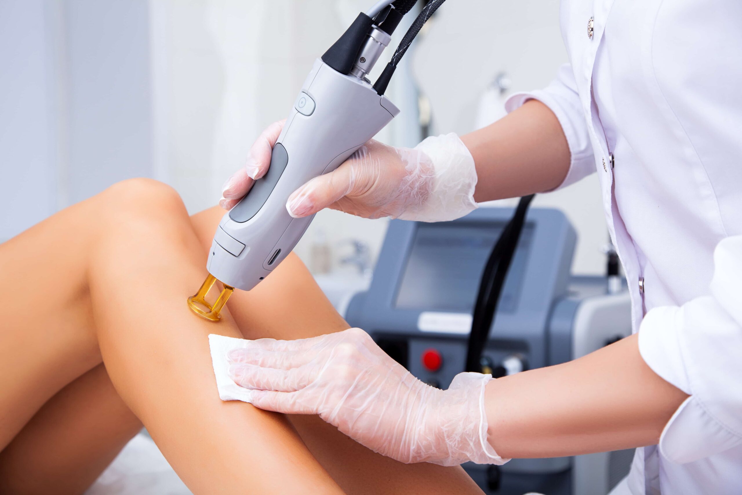 How Long Does Laser Hair Removal Actually Last?