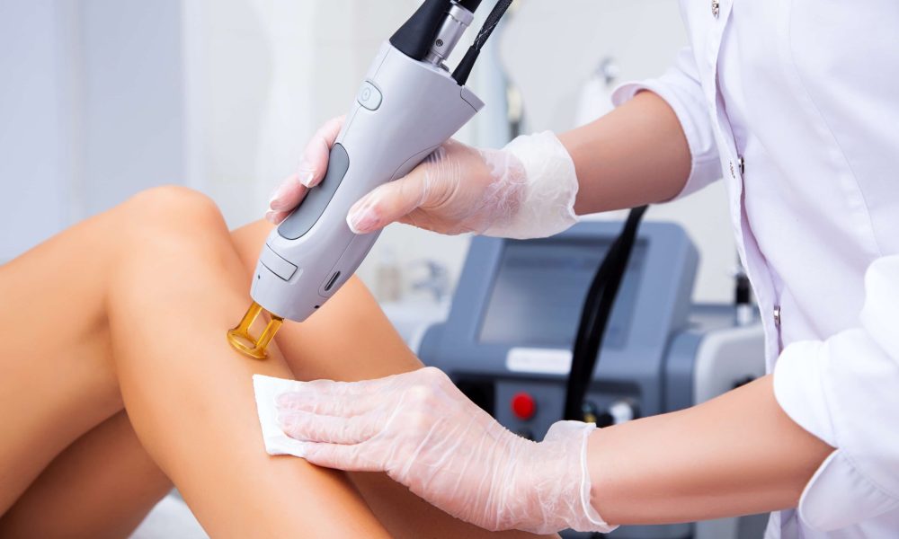 How Long Does Laser Hair Removal Actually Last?